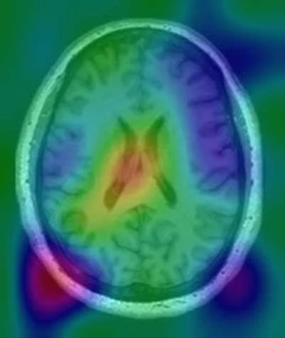 brain age 57